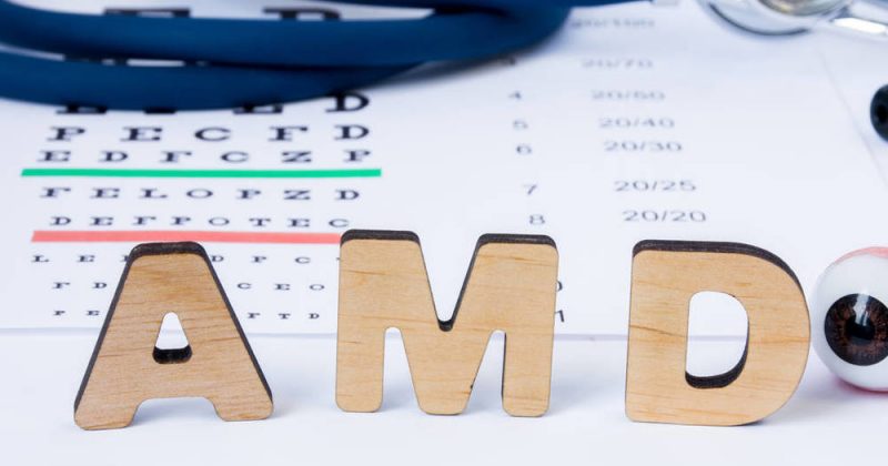 AMD的第N次逆袭：7nm芯片再挑英特尔服务器市场